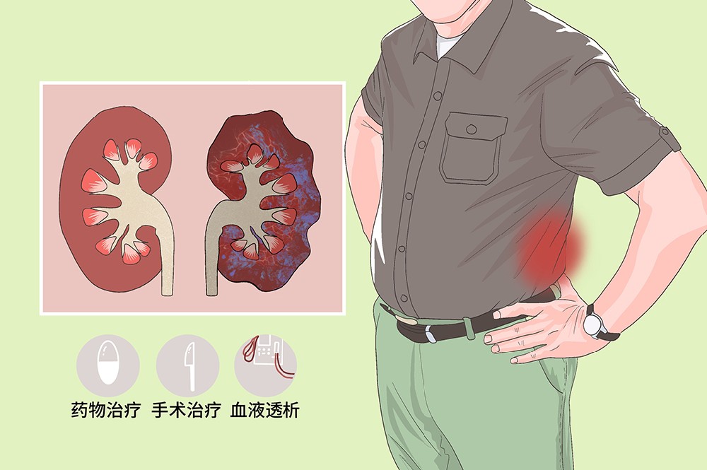 肾炎治疗.jpg