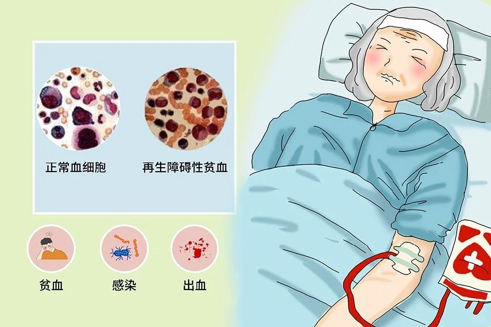 再生障碍性贫血.jpg