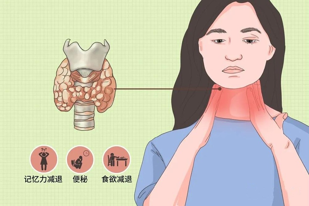 甲减_副本.jpg